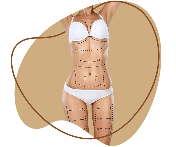 Liposuction