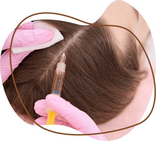 PRP hair treatment