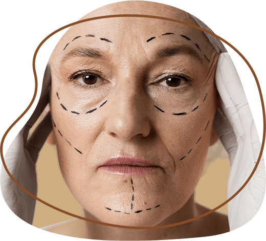 WRINKLES and fine line removal