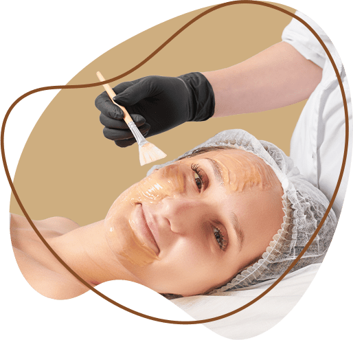 Chemical peel