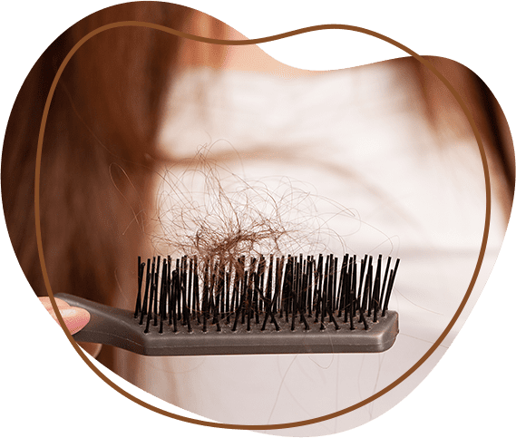 Hair fall tereatments