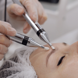 Forehead lift