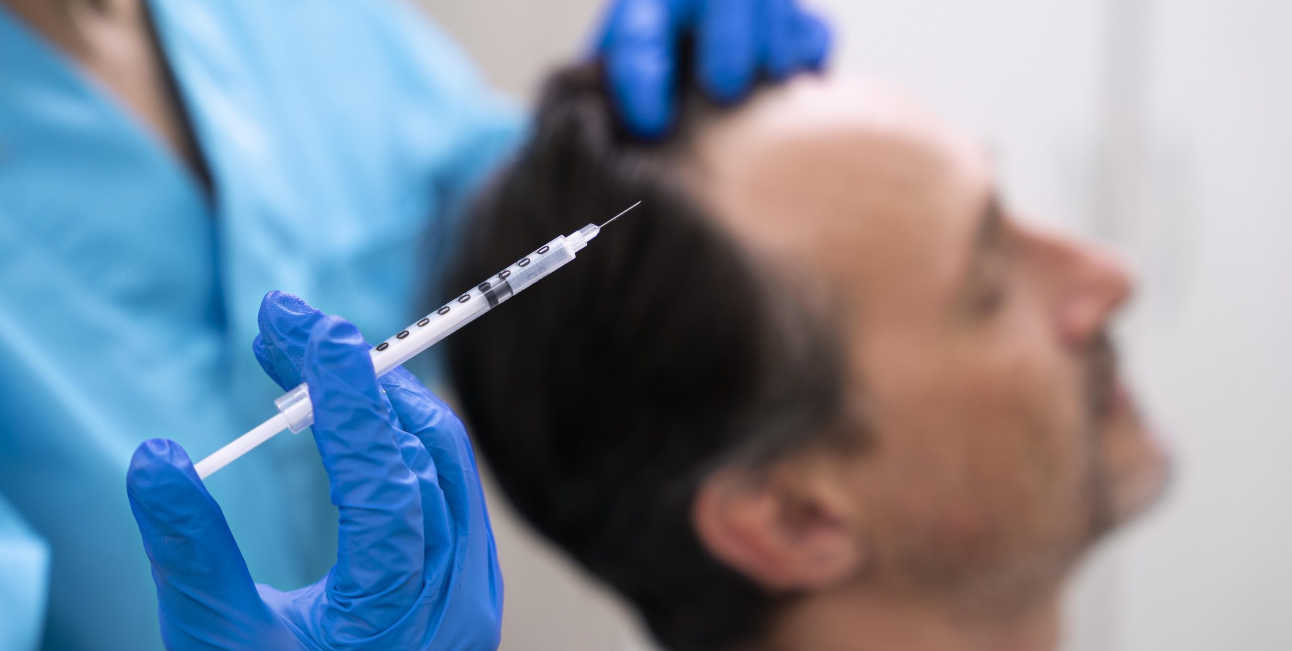 man-getting-hair-loss-treatment