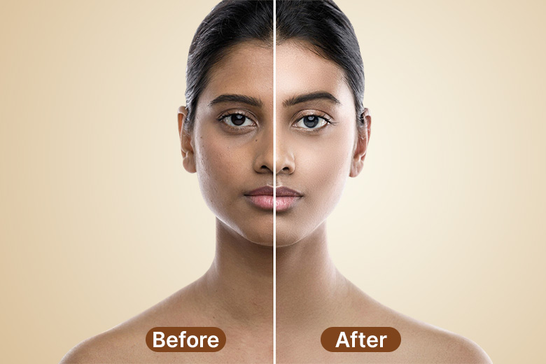 Skincare treatment at ReevanaX