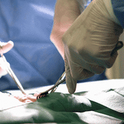 Clitoral Hood Plasty