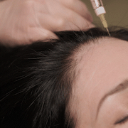 Hair Care Procedures