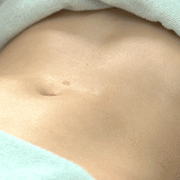 Skin Tightening