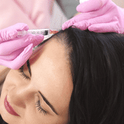 Stage wise baldness treatment