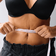 Tummy Tuck (abdominoplasty)