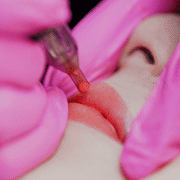 Barbie doll labioplasty