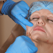 face rejuvenation