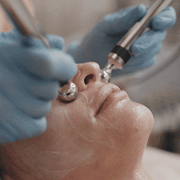 Facial Dimple Creation