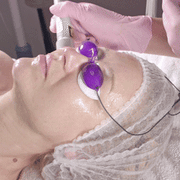 laser face lightening