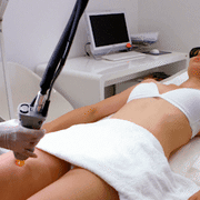 Laser Vaginoplsty Treatment