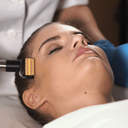 Micro Needling Treatment