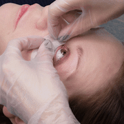 Under eye wrinkle removal